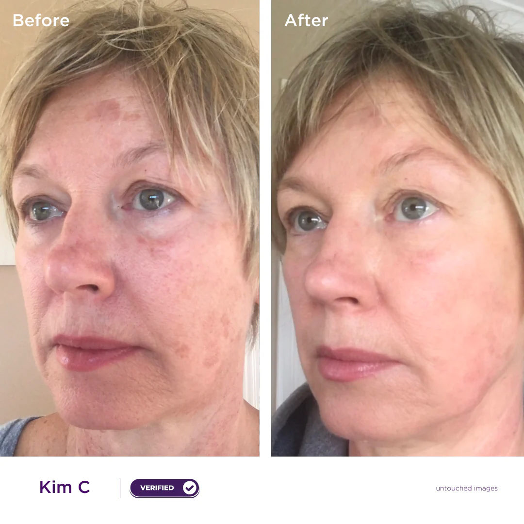 Anti-Aging Hero Kit - Image 5