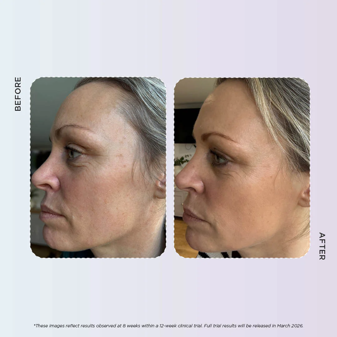 Enlighten Gold - Image 10