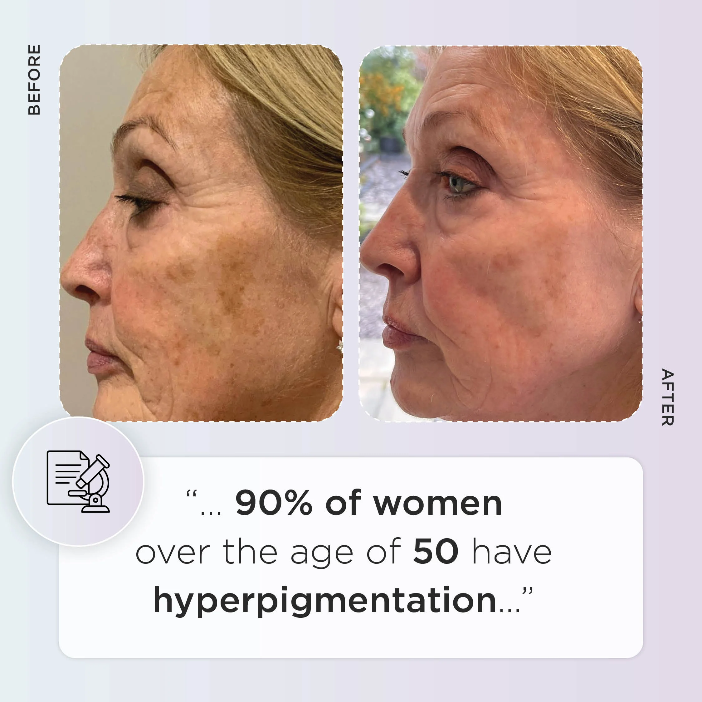 Enlighten Gold - Image 3