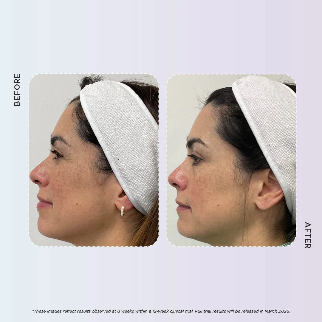 Enlighten Gold - Image 8