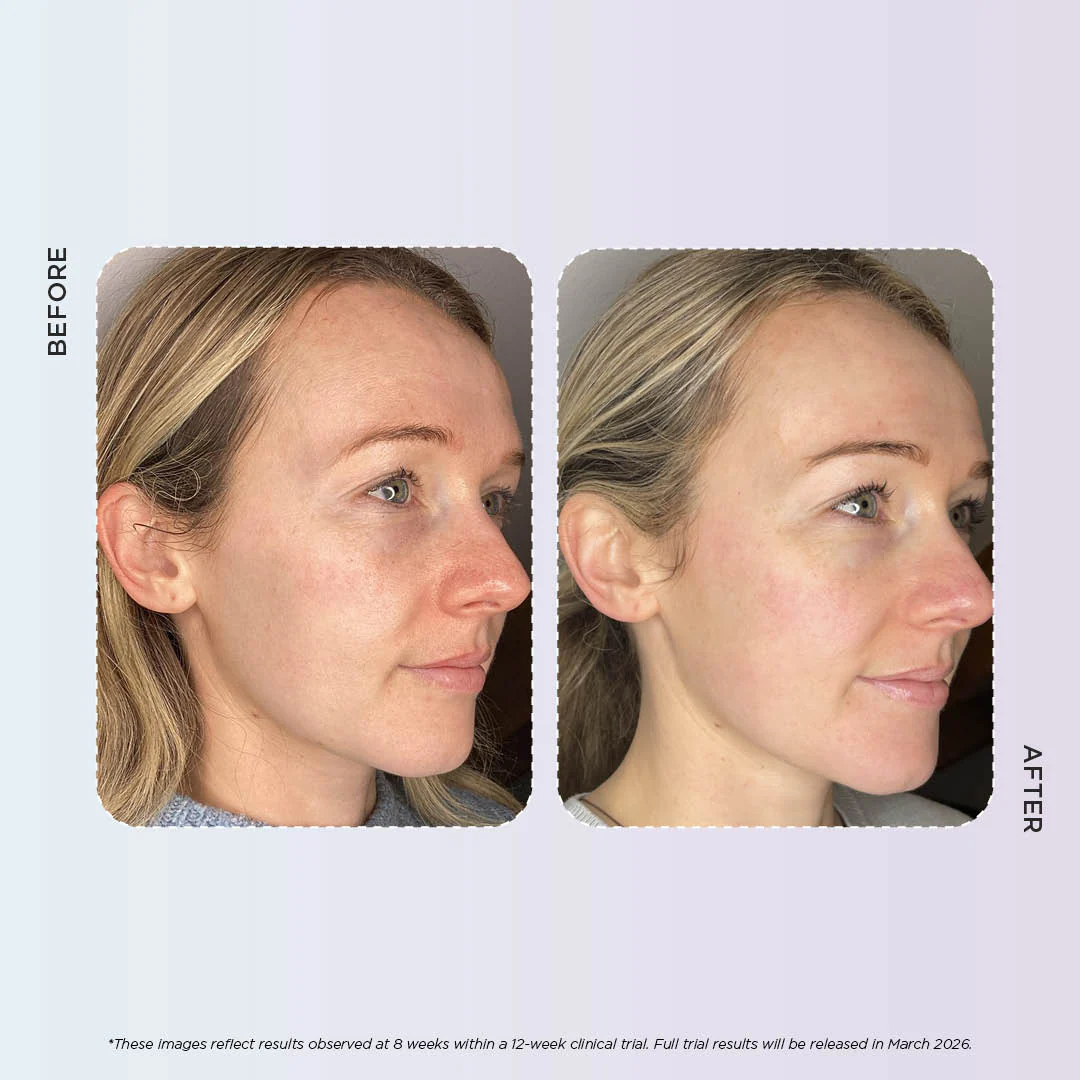 Enlighten Gold - Image 9